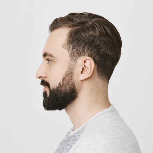 Mans profile, short brown hair, beard, light grey shirt. Hair Transplant Center Dallas TX