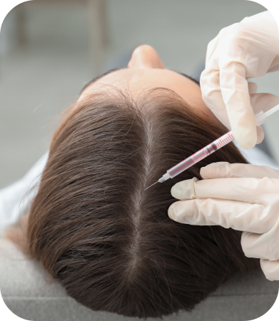 Female Hair Restoration