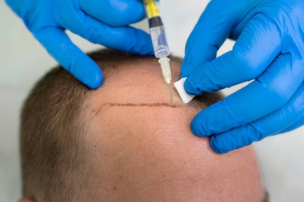 most reputable hair restoration clinic in dallas